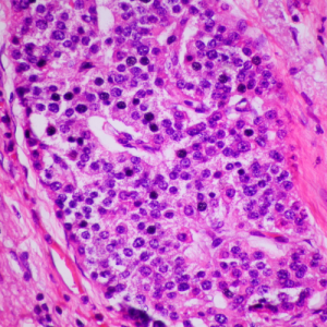 Neuroendocrine Cancer Research Lab